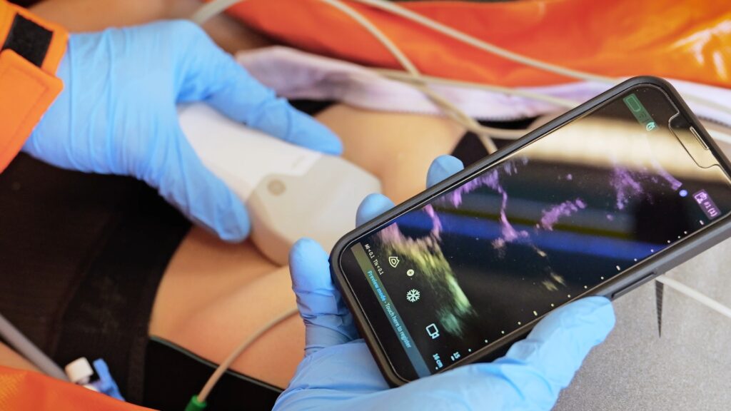 Katalonya'da Acil Sağlık Hizmetlerinde Devrim: Yeni Ambulanslar Ultrason ve Anında Kan