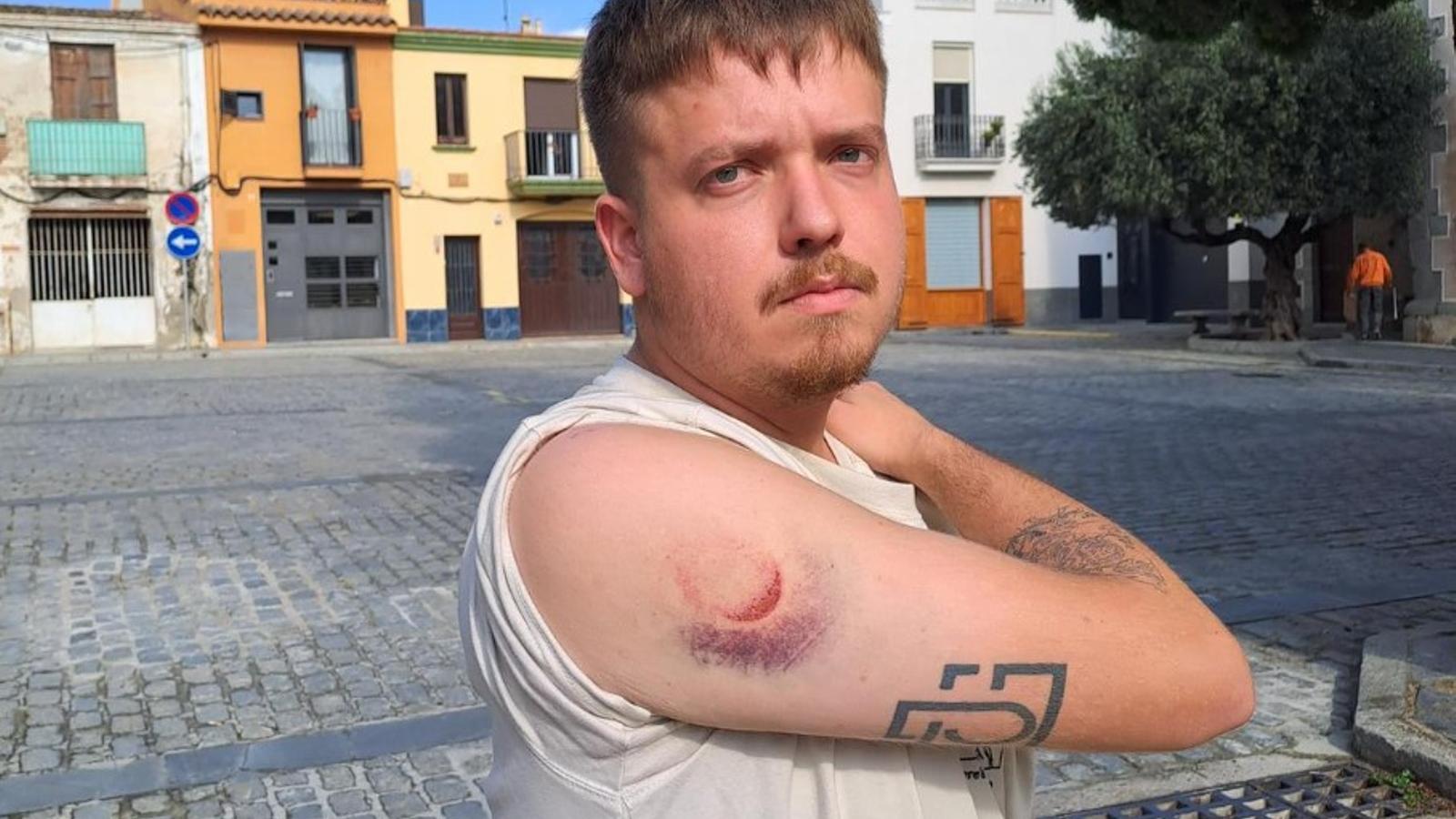Mossos'un İç Soruşturması Kapandı: Gazeteci Mağdur, Şeffaflık Tartışması Büyüyor
