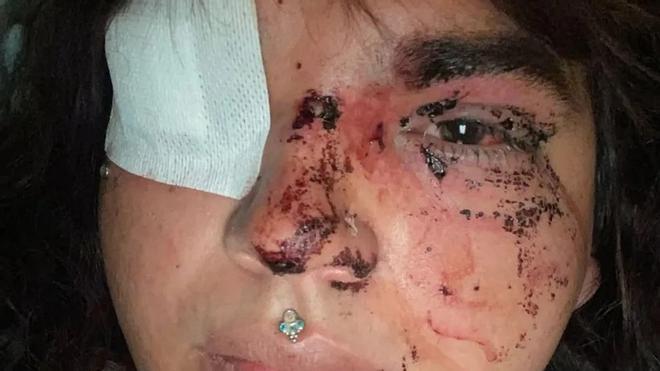 Miss Trans Zamora Bianca Lizbeth'e Transfobik Saldırı: "Hayatını Kaybetmenin Eşiğine