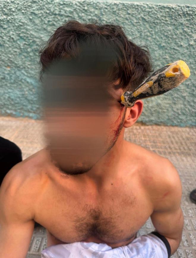 Alicante'de Kan Donduran Olay: Kavgada Başına Tornavida Saplanan Adam Ağır Yaralandı