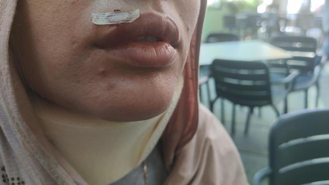 Manresa'da Müslüman Kadınlara Saldırı: 'Yine Başımıza Gelmesinden Korkuyoruz'