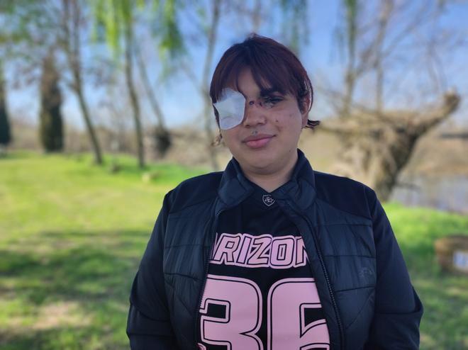 İspanya'da Trans Birey Bianca Fernández'e Şok Edici Transfobik Saldırı: "Nefretten Çok