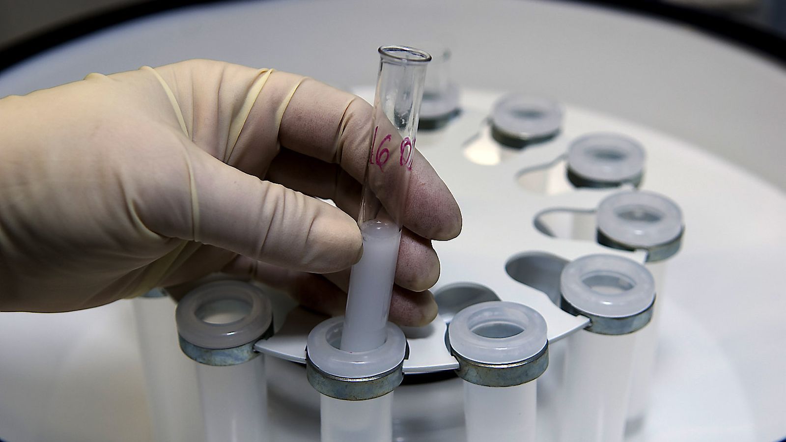 İspanya'da Bölgesel Farklılık: Kuzeydeki Erkeklerin Sperm Kalitesi Neden Daha Yüksek?
